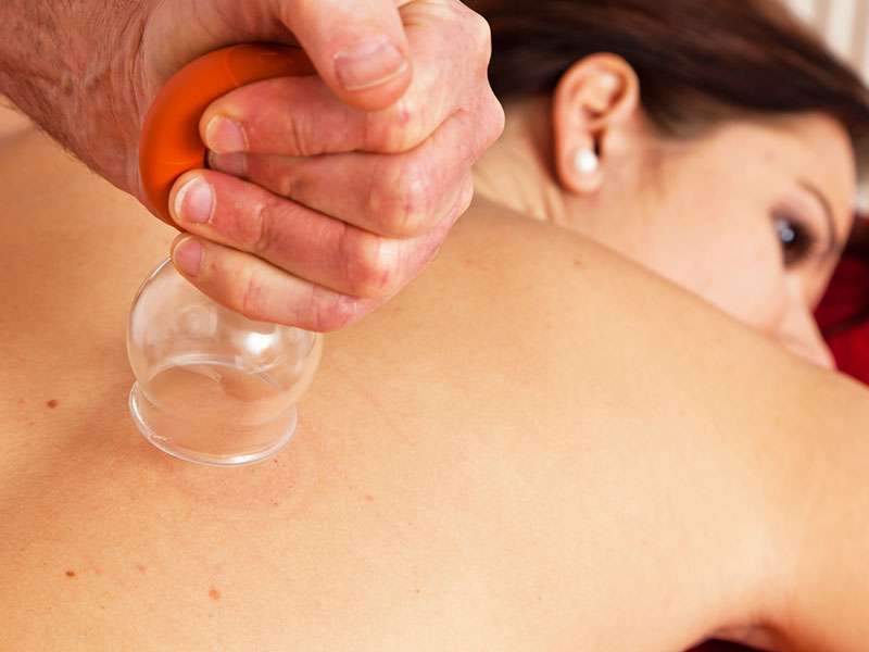Massage mobile Massage, Massage, Kosmetik, Micro Needling, Micro-needling, Ayurveda, Teneriffa, teneriffe, Cosmetic